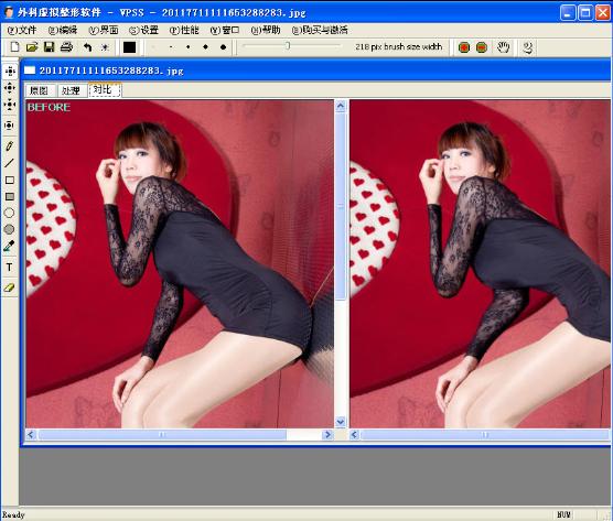 Virtual Plastic Surgery Software